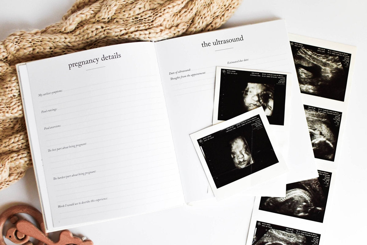 ultrasound photos on a photo journal